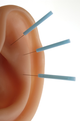 Ohrakupunktur Behandlung